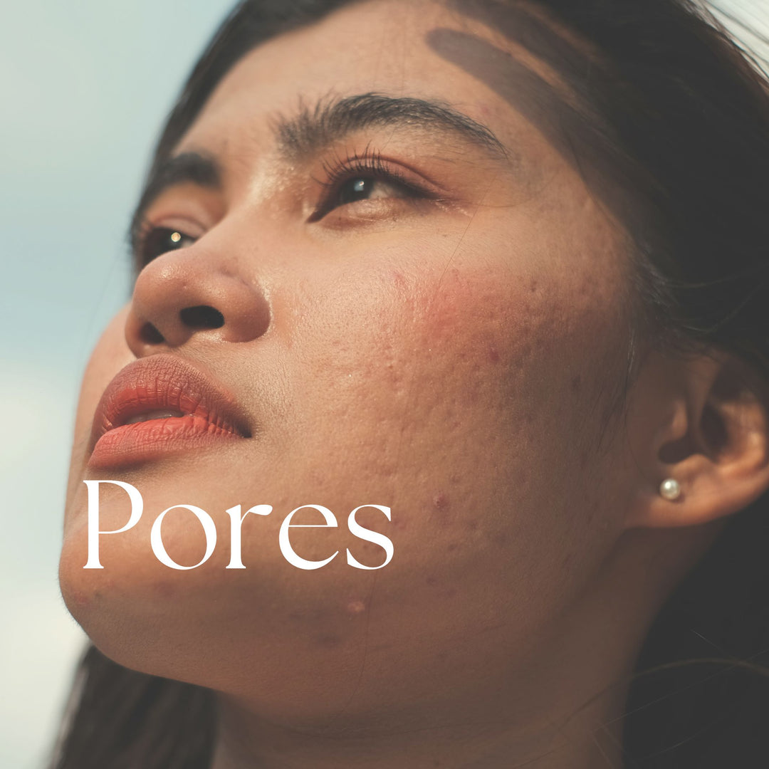 Pores