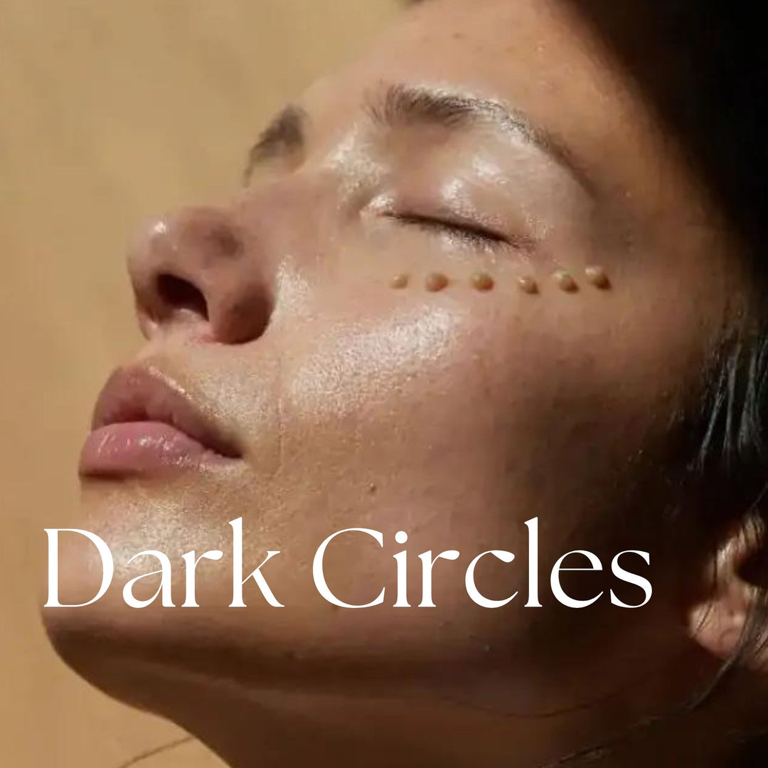 Dark Circles