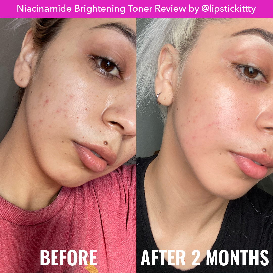 Niacinamide Brightening Toner